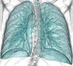 Lung cancer, CT systems, PACS Accessories, RSNA 2014