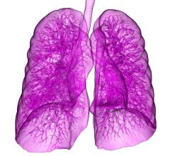 Adherence to Annual Lung Cancer Screening Needs Improvement