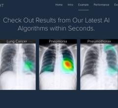 Lunit Insight Offers Cloud-Based AI Analysis for Chest X-rays