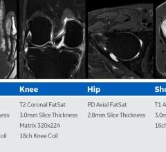 MRI