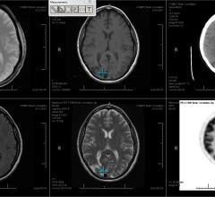 Machine Learning Techniques Generate Clinical Labels of Medical Scans