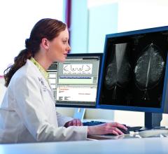 mammography breast density
