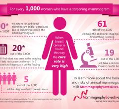  Mammography Screening Facts