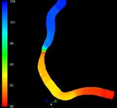 GE Healthcare and Medis Collaborate to Expand Availability of Quantitative Flow Ratio Software