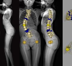 EOS Imaging System Installed at Massachusetts General Hospital