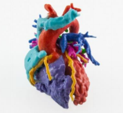 Multicolor model of a congenital heart defect.