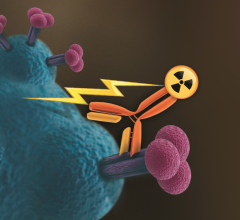 radiation therapy rsna 2013 imaging