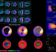 ASRT Supports Radiopharmaceutical Reimbursement Bill