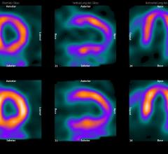 New Phase 2B Trial Exploring Target-Specific Myocardial Ischemia Imaging Agent