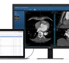 Children's Hospital Colorado to Manage Medical Images Via the Cloud With Nucleus.io Platform