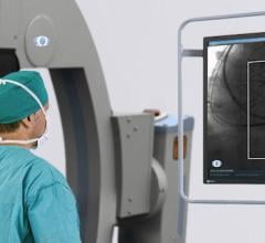 Omega Medical Imaging Launches AI-enabled FluoroShield for Radiation Reduction