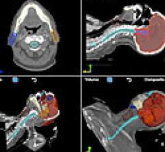 OncoView Offers PACS Features for Image-Based Oncology