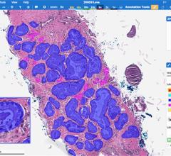 Push for Personalized Medicine Driving Whole Slide Imaging System Growth