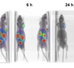 Double Targeting Ligands to Identify and Treat Prostate Cancer