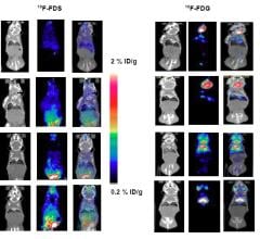 Novel PET Tracer Clearly Identifies and Tracks Bacterial Lung Infection