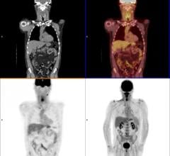 IBA Molecular, acquisition, Mallinckrodt Nuclear Imaging, nuclear imaging