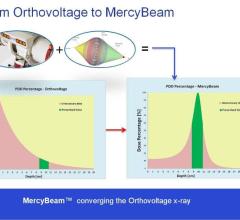 Convergent R.N.R Mercy Beam Technology Radiation Therapy