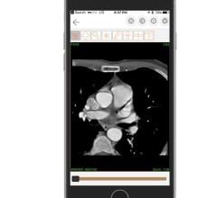 Paxeramed Demonstrates Patient-Centric Image Sharing Platform at RSNA 2017