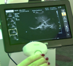 Ultrasound systems, RSNA 2014, Consortium