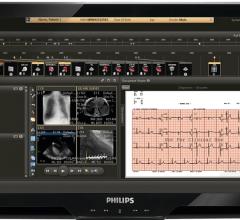 IntelliSpace Cardiovascular, Philips, CVIS, cardiac PACS