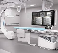 Philips Azurion Image-Guided Therapy Platform Improves Clinical Workflow for Interventional Procedures