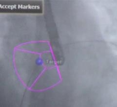 ASE Releases Guidelines for Transesophageal Echo in Congenital Heart Disease