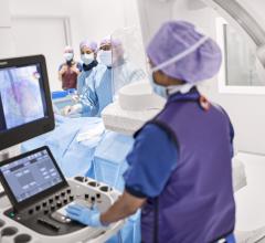 Philips Launches Epiq CVx and CVxi Cardiovascular Ultrasound Systems