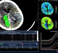 Philips Introduces IntelliSpace Enterprise Edition for Radiology