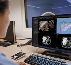 Philips Introduces IntelliSpace Portal 11 at ECR 2019