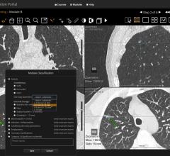 Doctor-Patient Discussions Neglect Potential Harms of Lung Cancer Screening