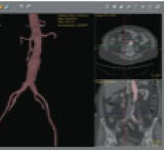 Patent Granted for Simbionix Procedure Rehearsal Studio