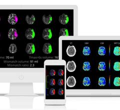 Gregory W. Albers, M.D., Receives Distinguished Clinical Research Achievement Award for Stroke Research