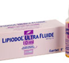 FDA Approves Lipiodol (Ethiodized Oil) to Image Tumors in Adults With Known Hepatocellular Carcinoma