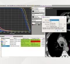 LAP is prioritizing clinical awareness, uptake and application of the automated 3D dose-check functionality now incorporated into its RadCalc QA software