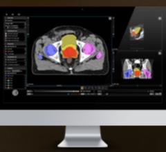 MIM Software Inc. Collaborating With Radialogica to Provide Monte Carlo Dose Calculation