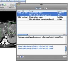 Breast Imaging Radiologists to Speak the Same Language