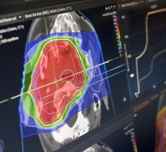 RayStation Selected for New Tennessee Proton Therapy Center