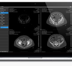 calgary resolutionmd remote viewing systems rsna 2013 software mobile devices