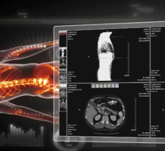 pacs accessories rsna 2013 scimage picom365