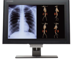 rsna 2013 flat panel displays canvys image systems xled