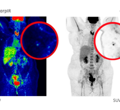 nuclear molecular imaging ge q.clear rsna 2013 pet systems q.suite