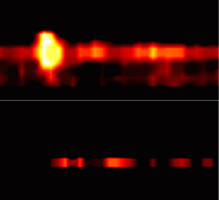 photoacoustic imaging