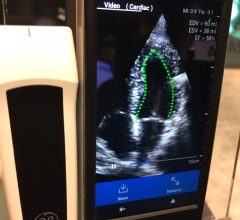 DiA’s novel solution leverages AI to transform the way clinicians capture and analyze ultrasound images