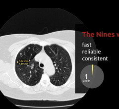 Nines announced the 510(k) FDA clearance for NinesMeasure, an innovative lung nodule measurement tool built with artificial intelligence (AI) that can accelerate diagnoses of certain respiratory diseases. 