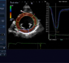 Echocardiographic Evaluation of Cancer Patients