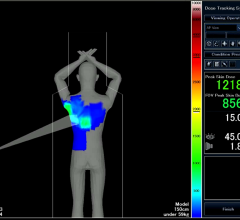 Toshiba radiation dose monitoring