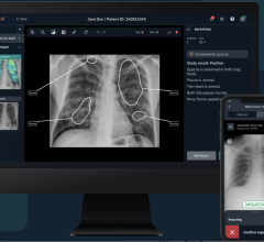 More than 1,700 US radiologists to gain easier access to the latest imaging AI solutions to drive radiology efficiency, clinical quality and patient care 