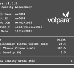 Matakina Internation Volpara Imaging Software 1.5.7 RSNA 2012