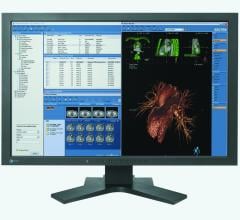 Australia's Largest Public Health System Selects Sectra for Enterprise Imaging IT Solution