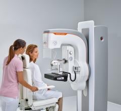 Women Prefer Getting Mammograms Every Year